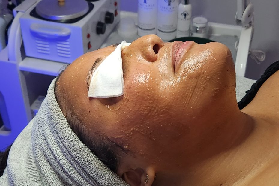 Woman getting a cocoa enzyme peel at Linde Esthetics and Wellness Studio in Springfield MO